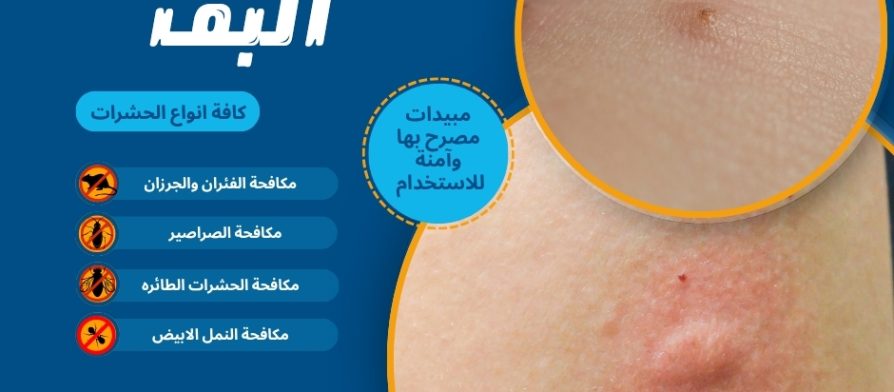 شكل قرصة البق