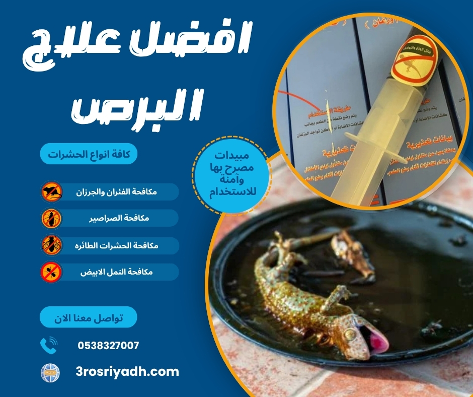 افضل علاج البرص