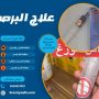 علاج البرص