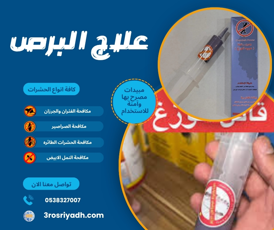 علاج البرص